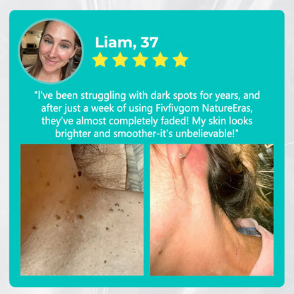 LOVILDS™ DermaErase Instant Mole & Spot Removal Gel